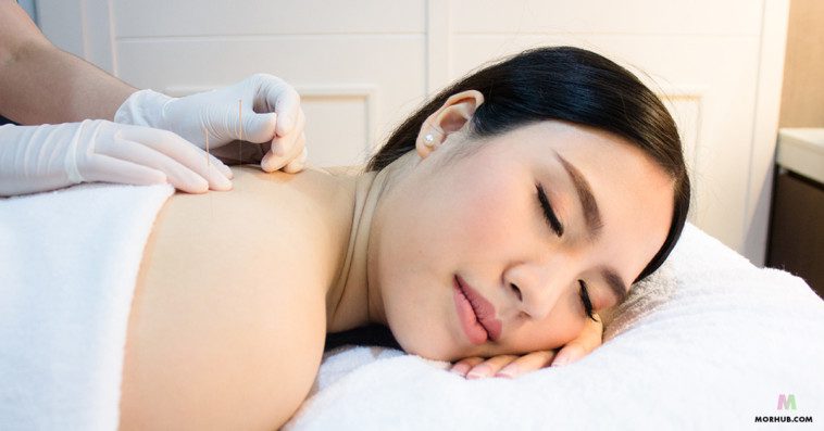 รีวิว ตรวจสุขภาพ ฝังเข็ม & เติมวิตามิน ที่ The Scarlett Clinic พารากอน