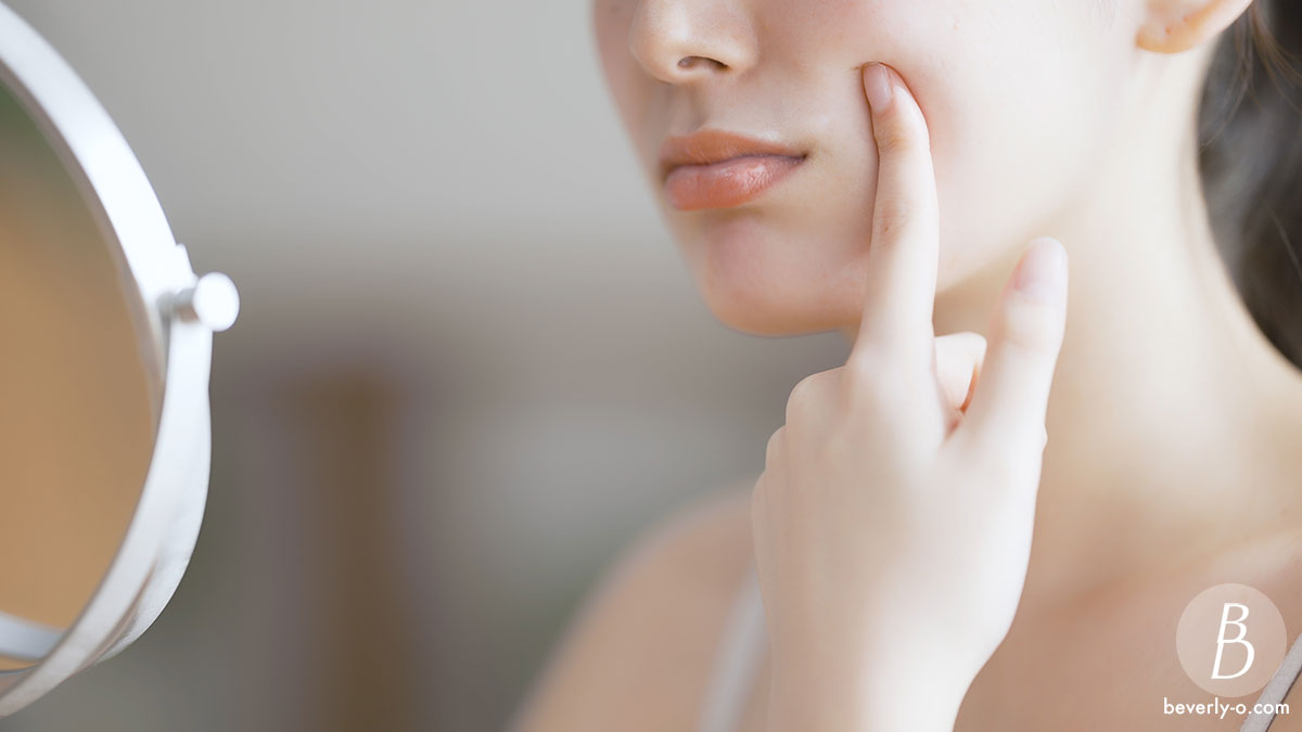 สิวผดที่หน้าผากเกิดจากอะไร รักษายังไง